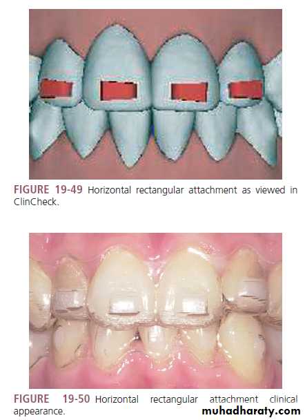 Invisalign in orthodontics pptx - د.افراح (كلاسروم) - Muhadharaty