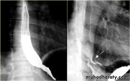 Esophagus Docx - D. Haider - Muhadharaty