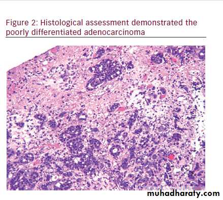 Esophagus docx - D. Haider - Muhadharaty