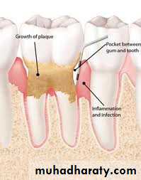 oral hygiene measures pptx - د. خولة ( كلاسرووم) - Muhadharaty