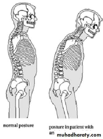 Seronegative Arthritis pptx - D. Fadhil - Muhadharaty