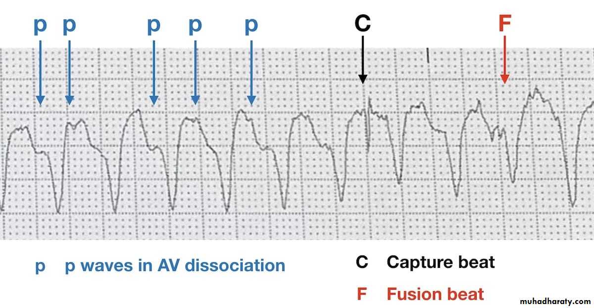 ECG pptx - محمد هاشم الموسوي - Muhadharaty