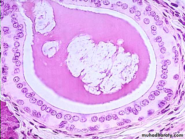 Stratified Epithelium Pptx D Talib Muhadharaty