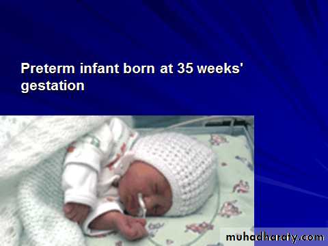 Low Birth Weight pptx - سجال فاضل فرهود - Muhadharaty