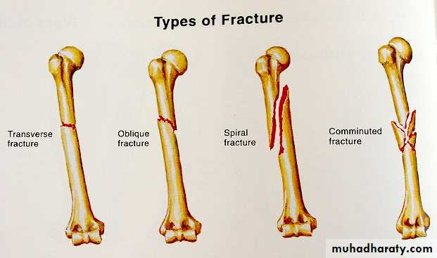 Introduction to Fractures pptx - D. Wahby - Muhadharaty