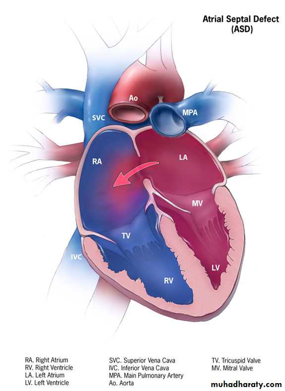 Acyanotic Heart Diseases pptx - D. Ahmed Abd Al-Ameer - Muhadharaty