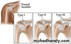 Dislocation Of Shoulder Joint Docx - D. Khalid - Muhadharaty