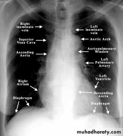 Chest C-ray pptx - اسامة اياد - Muhadharaty