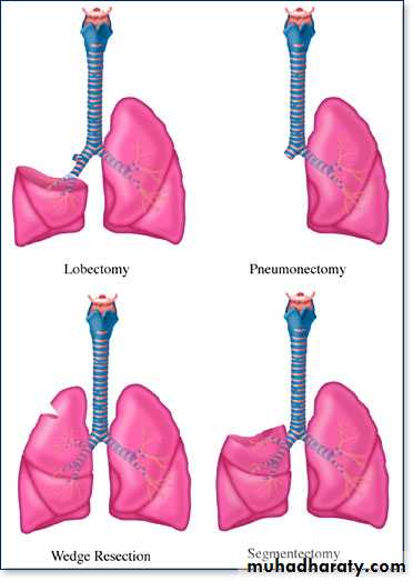 physical properties of the Lungs pptx - D. Suroor - Muhadharaty